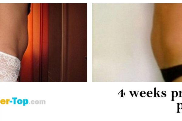 Kraken ссылка onion 2kmp